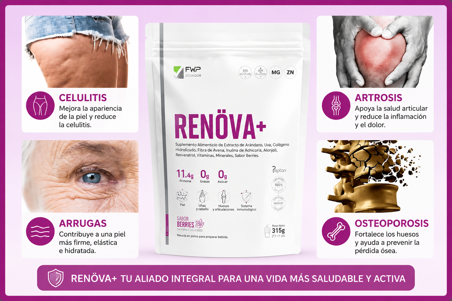 Efectos en celulitis, arrugas y artrosis